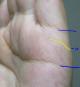 �葊�摜(�֘A����葊�Ӓ�)���z���|�����z�������ΐ��u���琶���Ă���(�Ӓ�No.00323)