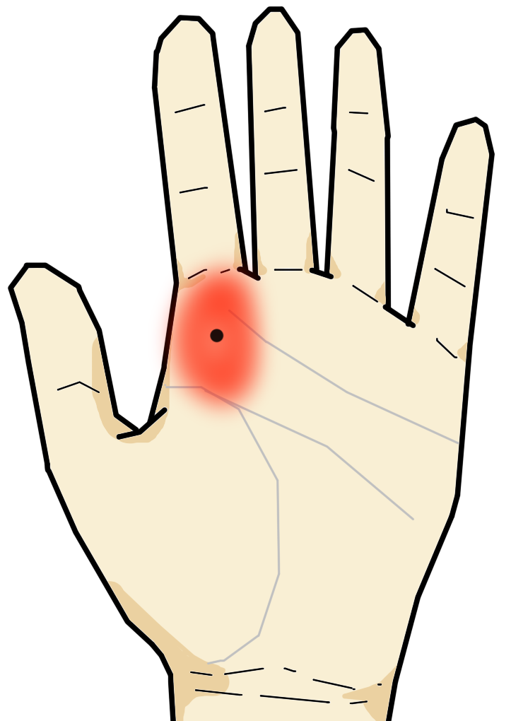 手相から見たホクロ シミの意味 手相の見方ここにあり
