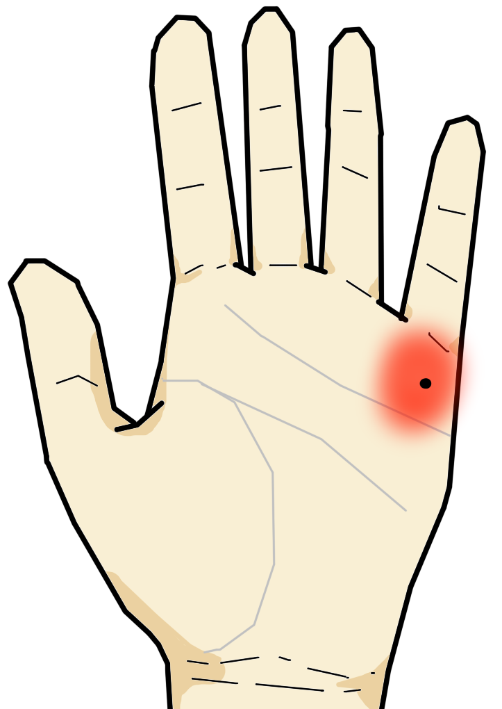 手相から見たホクロ シミの意味 手相の見方ここにあり