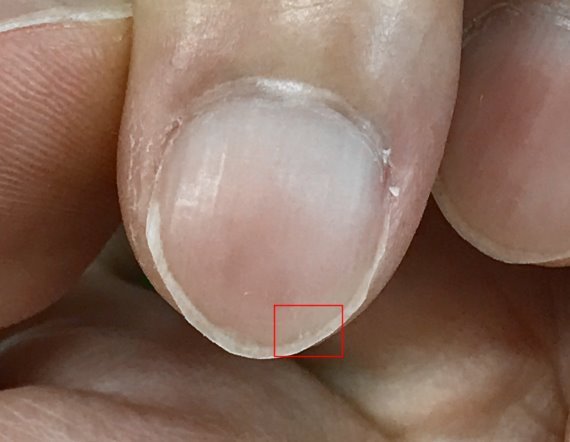 人差し指の爪に生じる黒点 白点 手相の見方ここにあり