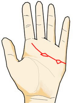 手相と記号と島 アイランド 手相の見方ここにあり